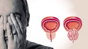 Healthy and inflamed prostate
