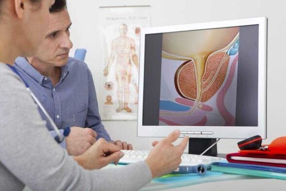 the doctor consults with the patient on the issue of prostatitis