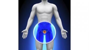 prostatitis in a man