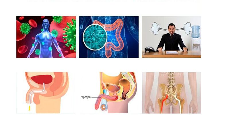 Causes of prostatitis