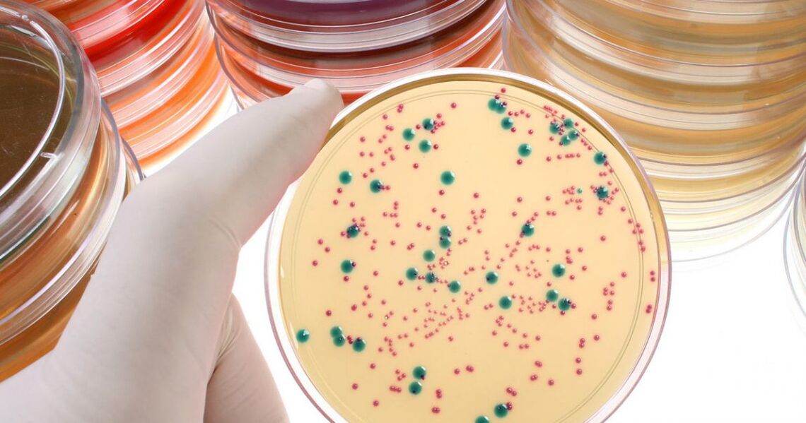 Chronic bacterial prostatitis is detected by analyzing urine and prostate secretions